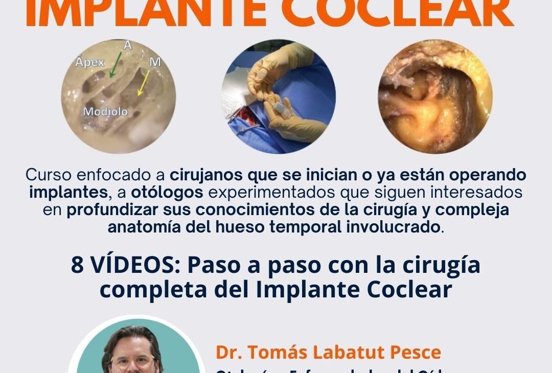 Curso de Cirugía Implante Coclear