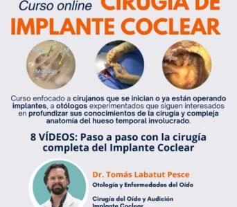 Curso de Cirugía Implante Coclear